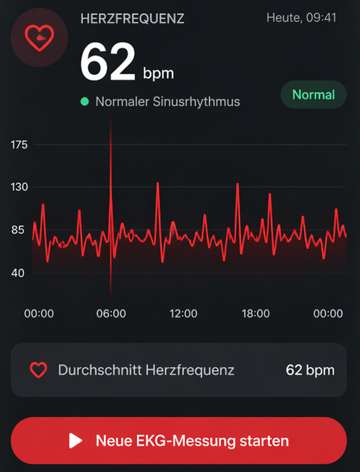 SOMA 3.0 – Smart Activity Tracker